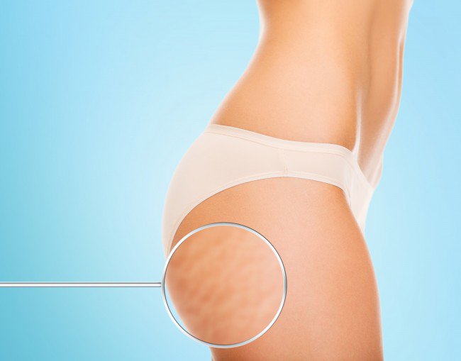 cellulite waterpill nutreov be well in beirut